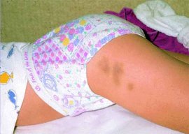 Châtiment corporel à l'encontre des enfants en Algérie, les chérubins maltraités au nom de la discipline 