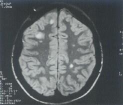 HANDICAP … EN TOUTE FRANCHISE … JE DENONCE 