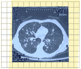 2005 : année métastasique