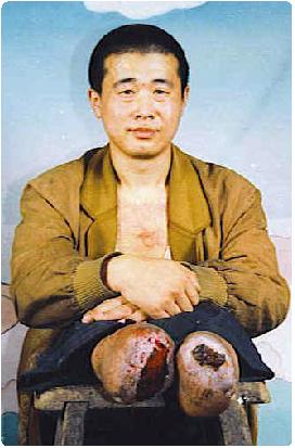 Sujiatun : la conscience à l'épreuve