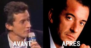 Christophe Dechavanne s'est-il fait refaire le nez ?