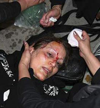 Vidéo insoutenable de la répression en Iran