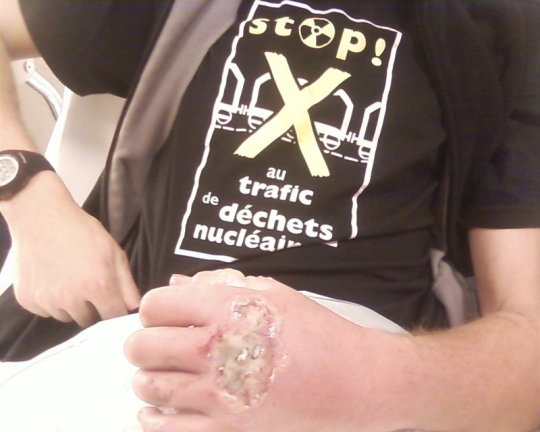 Police partout, justice nulle part, ça se passe comme ça au Sarkoland